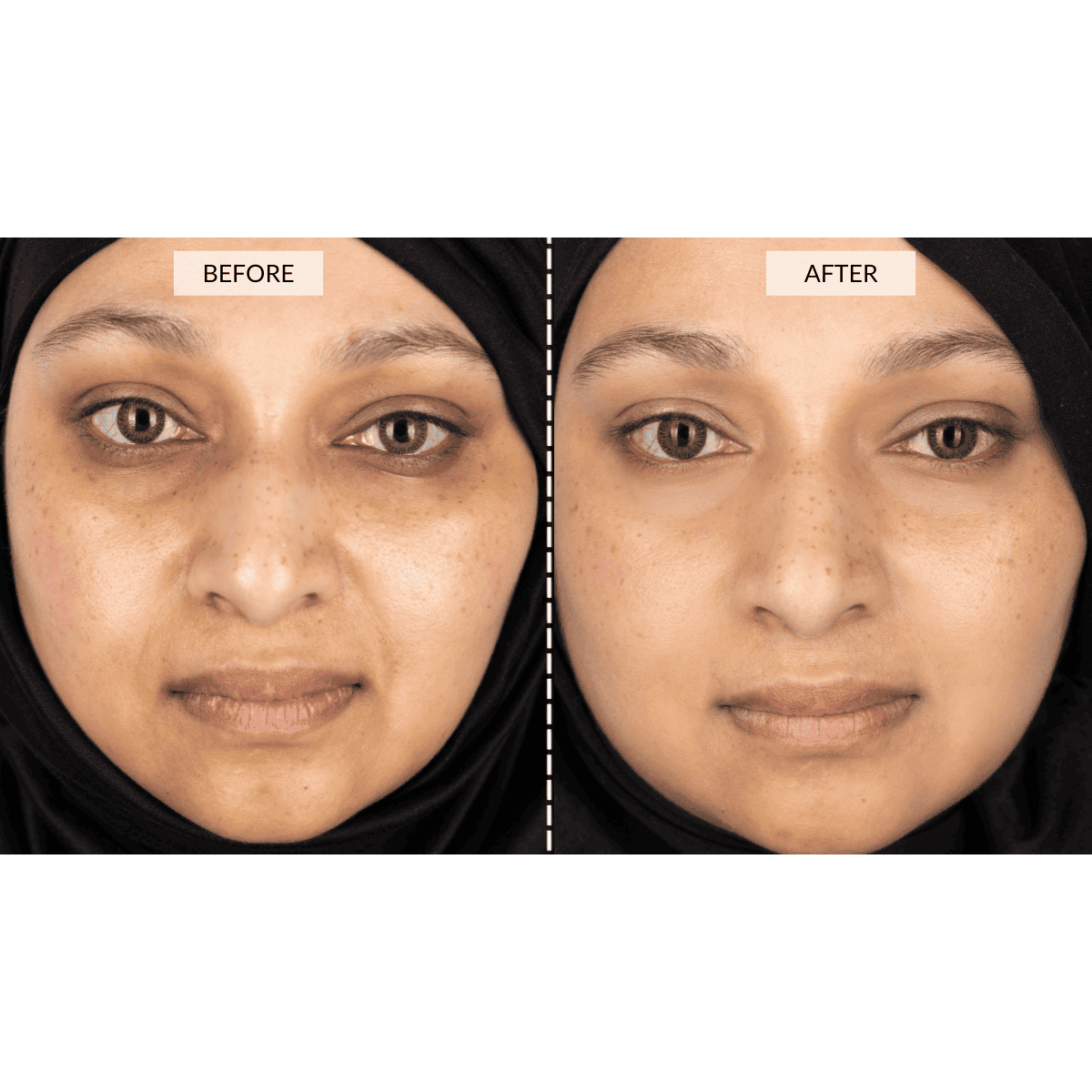 Silver Series 1 LED Mask Gift Set