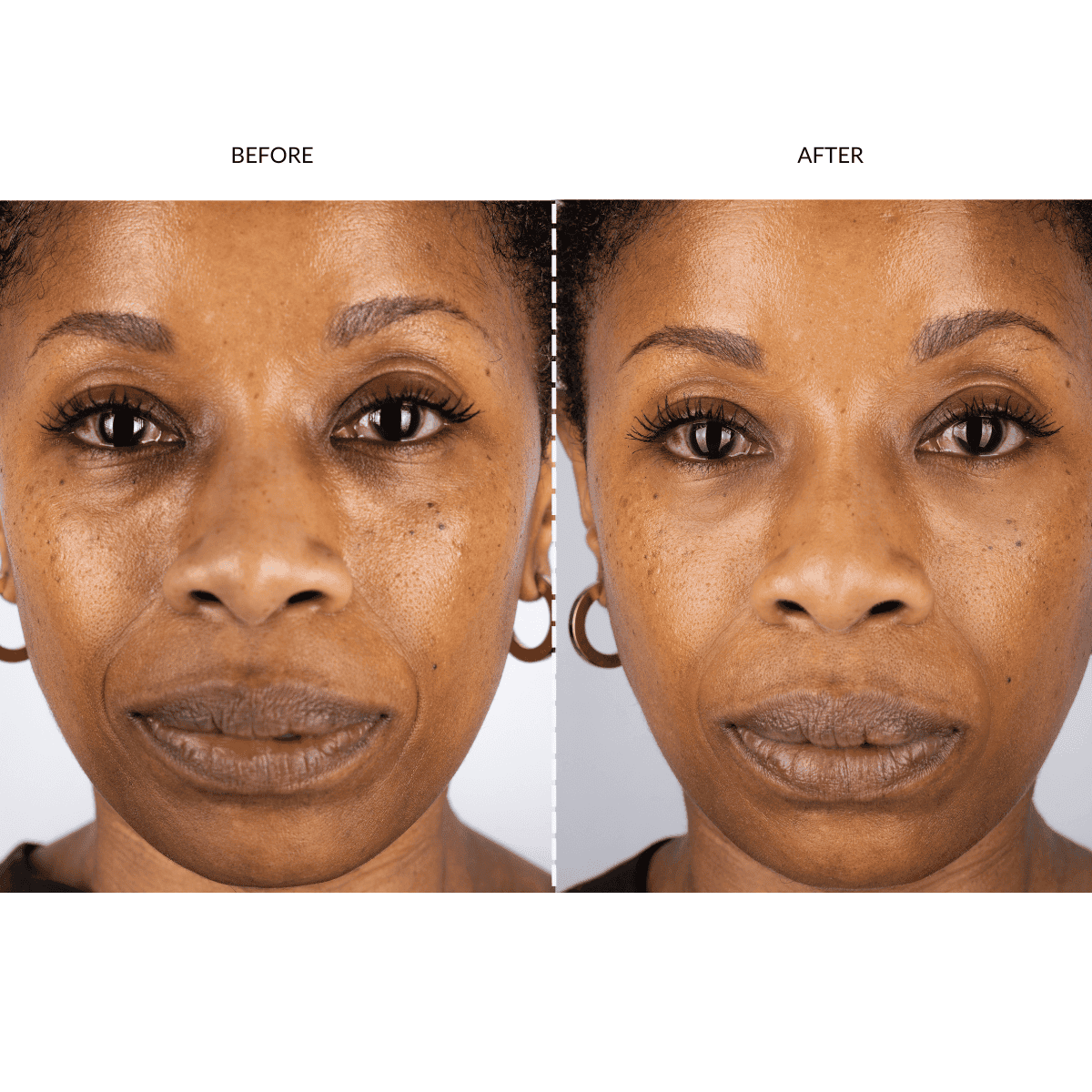 Silver Series 1 LED Mask Gift Set